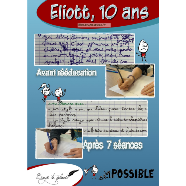 Les progrès d'Eliott, 10 ans, après 7 séances de rééducation.